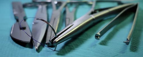 Szálbehúzás (Thread lifting) beavatkozás - Szemhéjplasztika mindenkinek - Dr. Boros László